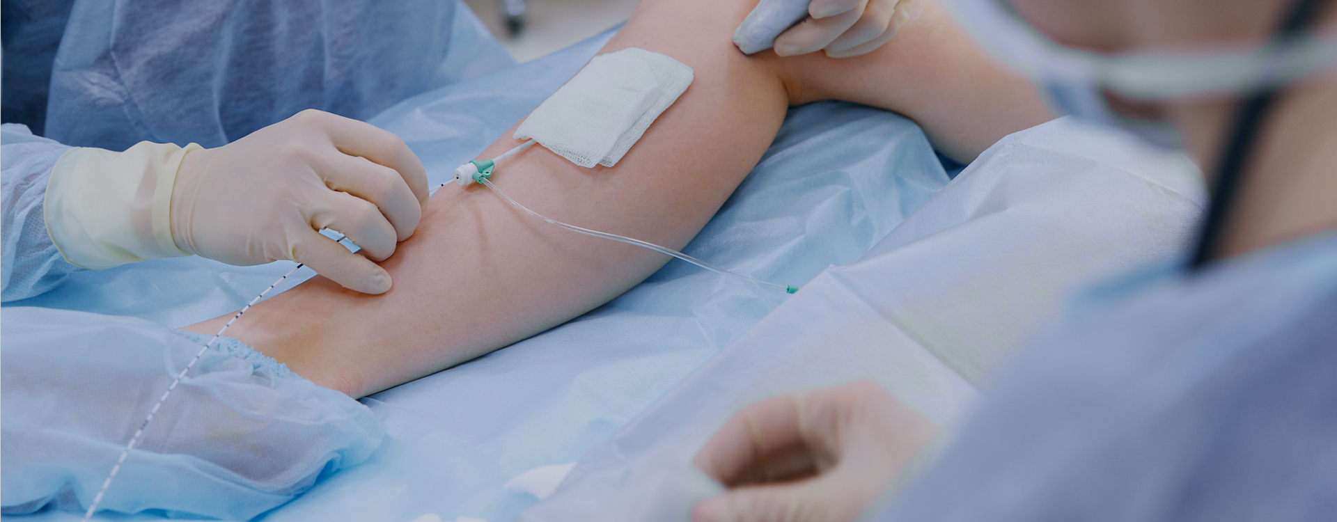 cirugia endovascular especialidad