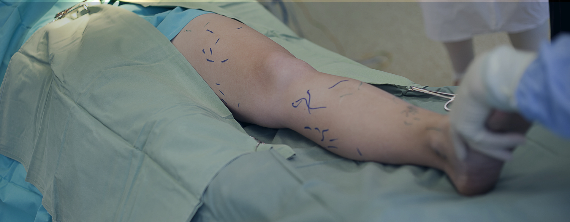 ulceras venosas especialidad