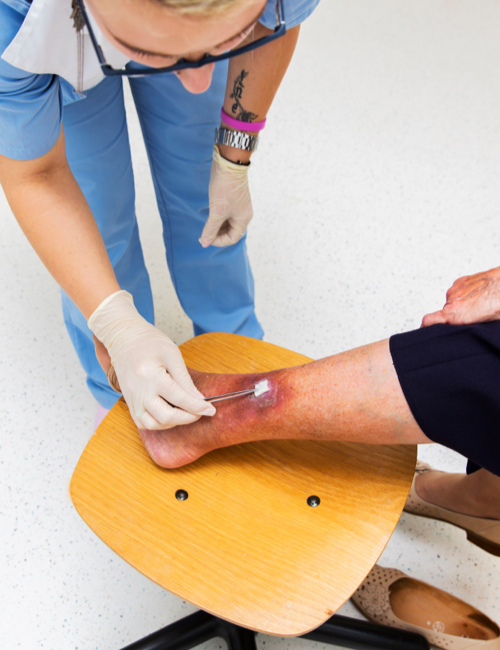 servicios de ulceras venosas